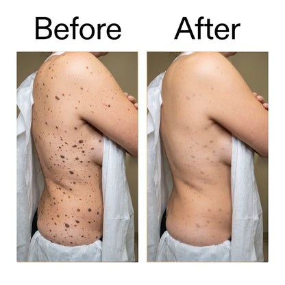 Daily Dissolve Body Stick